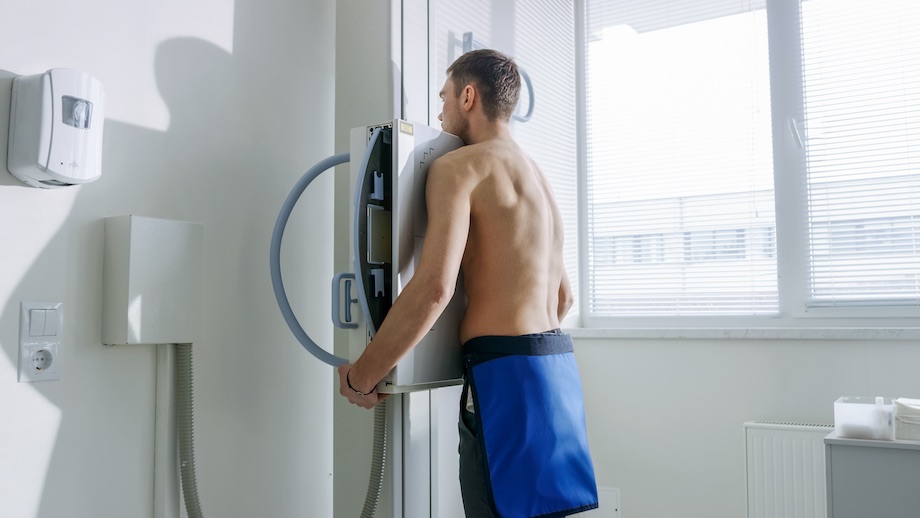 Cancer du poumon le dépistage recommandé chez les patients avec une